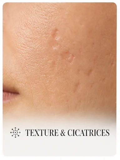 Illustration — Texture & cicatrices